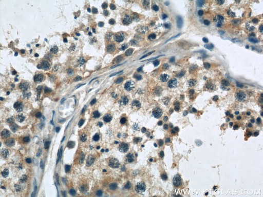 [21377-1-AP-20UL] SASS6 Polyclonal antibody