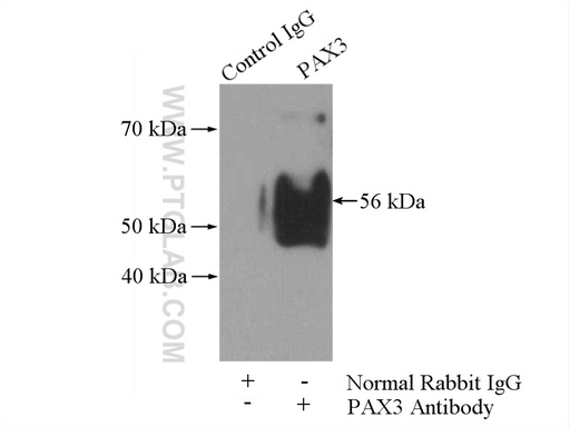 [21386-1-AP-20UL] PAX3 Polyclonal antibody