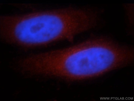 [21390-1-AP-150UL] CCDC153 Polyclonal antibody