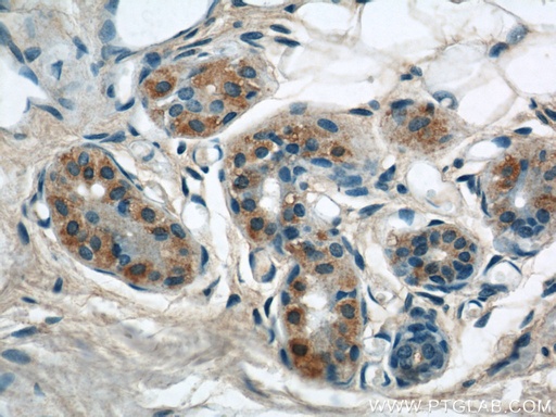 [21392-1-AP-150UL] KIAA1602 Polyclonal antibody