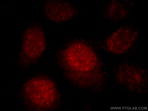 [21393-1-AP-20UL] RNF168 Polyclonal antibody