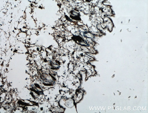 [21395-1-AP-20UL] SGSM1 Polyclonal antibody