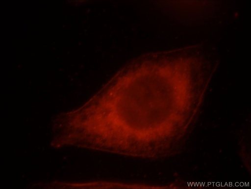 [21396-1-AP-150UL] ERC2 Polyclonal antibody