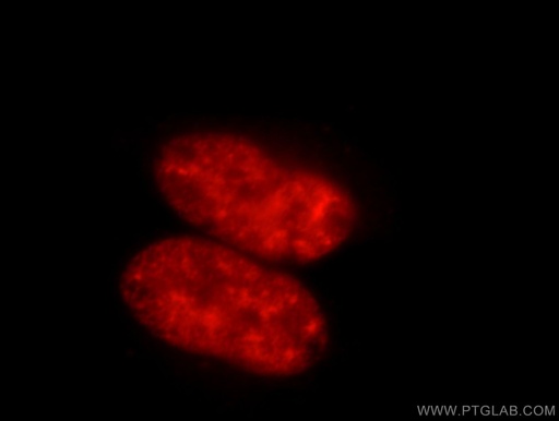 [21399-1-AP-150UL] SR140 Polyclonal antibody