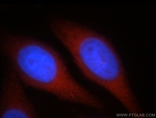 [21400-1-AP-150UL] SPATA13 Polyclonal antibody