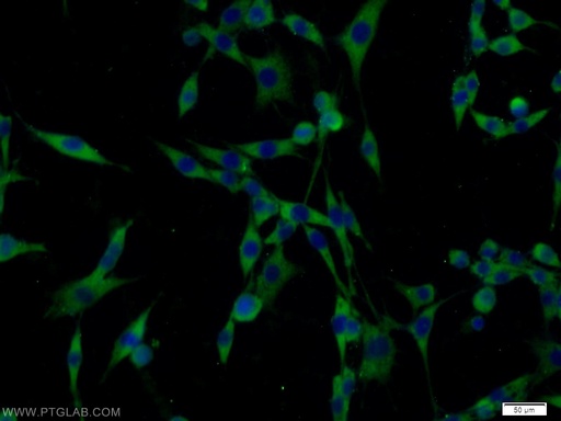 [21401-1-AP-150UL] PAK1 Polyclonal antibody