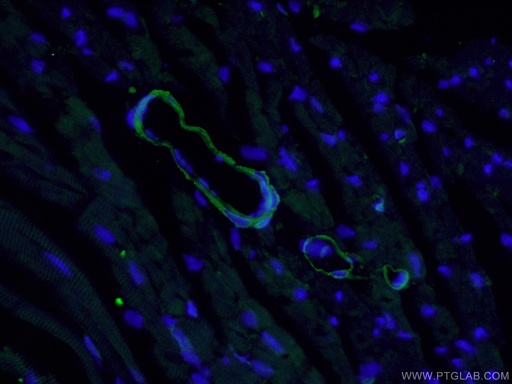 [21404-1-AP-20UL] SMMHC Polyclonal antibody