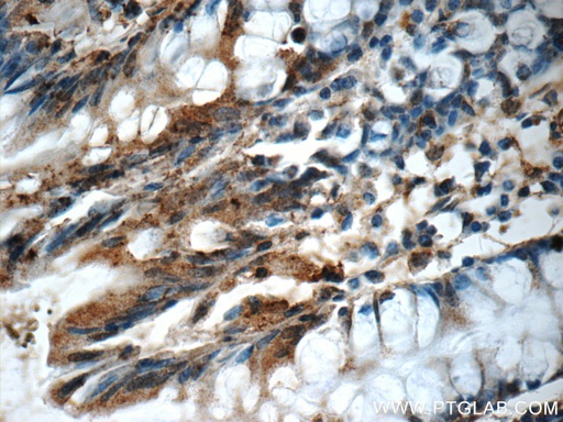 [21424-1-AP-20UL] CDC42SE2 Polyclonal antibody