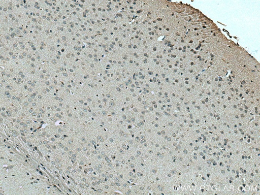[21430-1-AP-150UL] SLC24A6 Polyclonal antibody