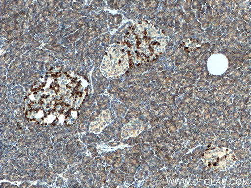 [21432-1-AP-20UL] CHIT1 Polyclonal antibody