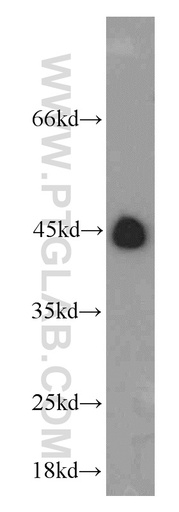 [21438-1-AP-20UL] RNF150 Polyclonal antibody