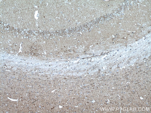 [21446-1-AP-20UL] PEA15 Polyclonal antibody