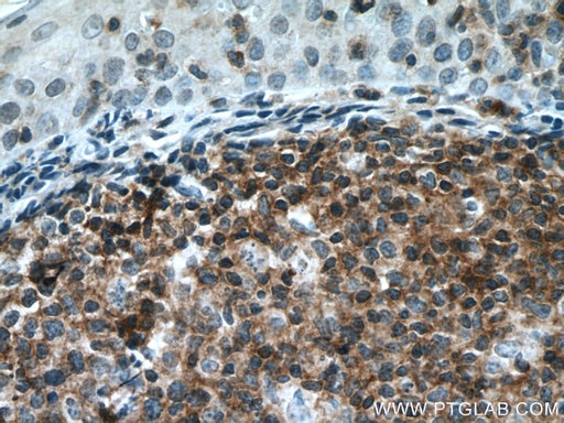 [21448-1-AP-20UL] PVRIG Polyclonal antibody