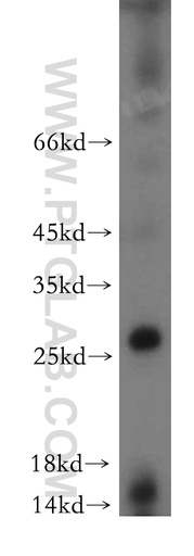 [21456-1-AP-20UL] C1orf77 Polyclonal antibody