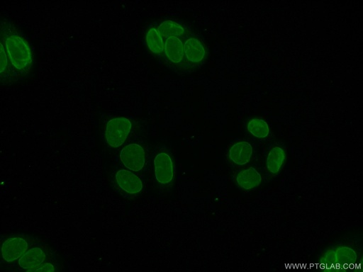 [21459-1-AP-150UL] TOR1AIP1 Polyclonal antibody