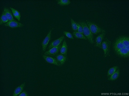 [21460-1-AP-20UL] PRH1 Polyclonal antibody