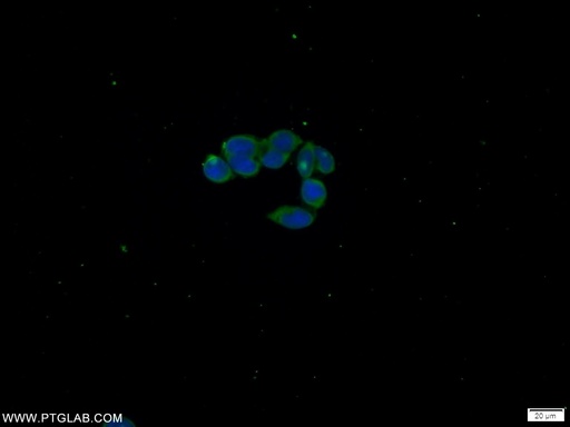 [21461-1-AP-150UL] C21orf59 Polyclonal antibody