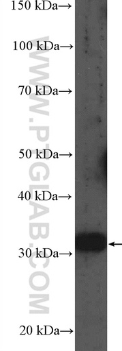 [21462-1-AP-150UL] MMACHC Polyclonal antibody