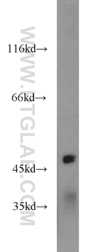 [21465-1-AP-150UL] IGSF21 Polyclonal antibody