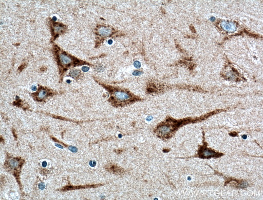 [21466-1-AP-150UL] TMEM230 Polyclonal antibody