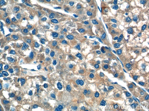 [21481-1-AP-150UL] F9 Polyclonal antibody