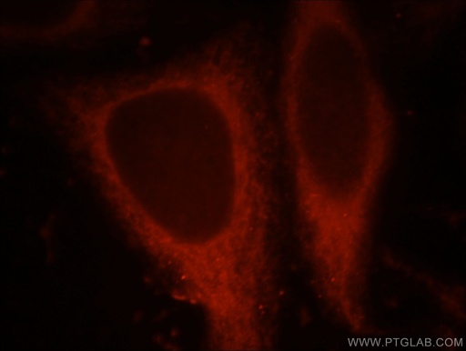 [21484-1-AP-150UL] CHIA Polyclonal antibody