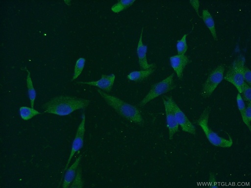 [21491-1-AP-20UL] MAGEC3 Polyclonal antibody