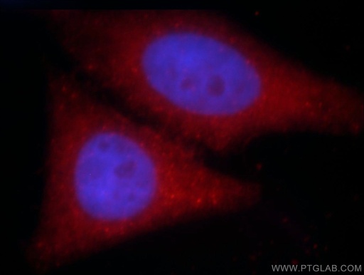 [21499-1-AP-20UL] SH3D19 Polyclonal antibody