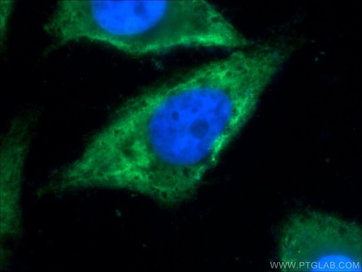 [21502-1-AP-150UL] TXNDC16 Polyclonal antibody