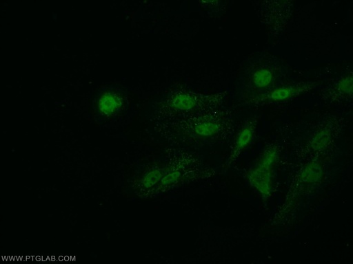 [21505-1-AP-150UL] Arp5/ACTR5 Polyclonal antibody