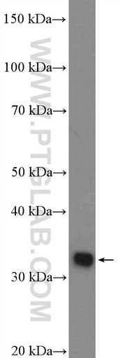 [21509-1-AP-150UL] POU4F3 Polyclonal antibody