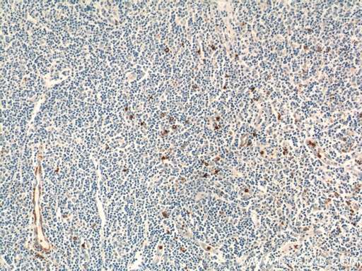 [21510-1-AP-20UL] KLRF1 Polyclonal antibody