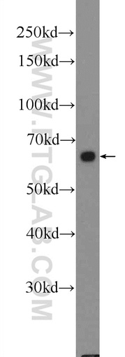 [21519-1-AP-20UL] Frizzled 5 Polyclonal antibody
