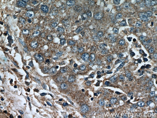 [21524-1-AP-20UL] CCT4 Polyclonal antibody
