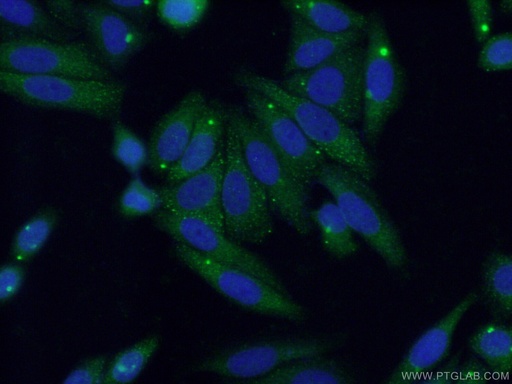 [21527-1-AP-150UL] MYLK3 Polyclonal antibody