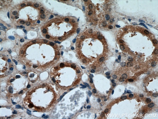 [21535-1-AP-20UL] FOXO4 Polyclonal antibody
