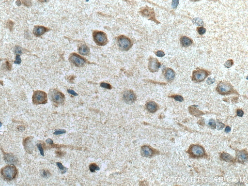 [21537-1-AP-150UL] FAM134B Polyclonal antibody