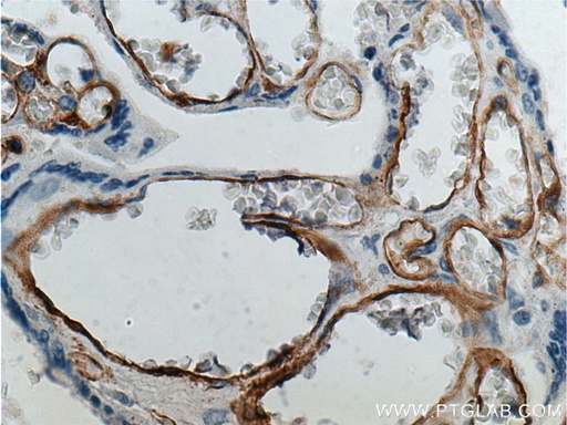 [21541-1-AP-150UL] FCGR2B / CD32b Polyclonal antibody