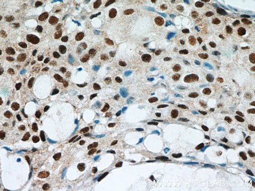 [21542-1-AP-150UL] GABPA Polyclonal antibody