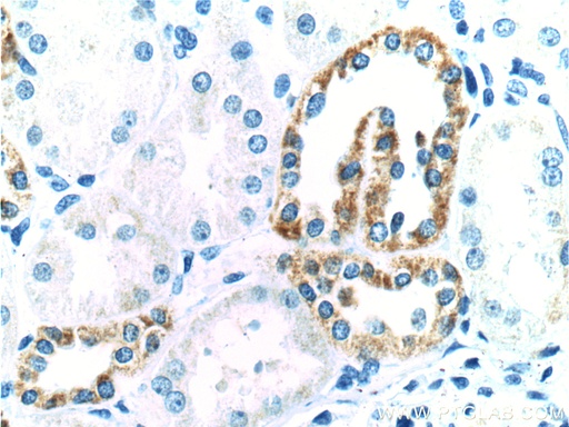 [21546-1-AP-150UL] TLL2 Polyclonal antibody