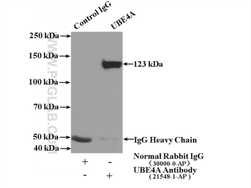 [21548-1-AP-150UL] UBE4A Polyclonal antibody