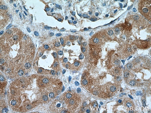 [21549-1-AP-20UL] NRBP2 Polyclonal antibody