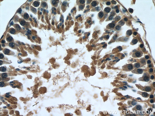 [21552-1-AP-20UL] MARK1 Polyclonal antibody