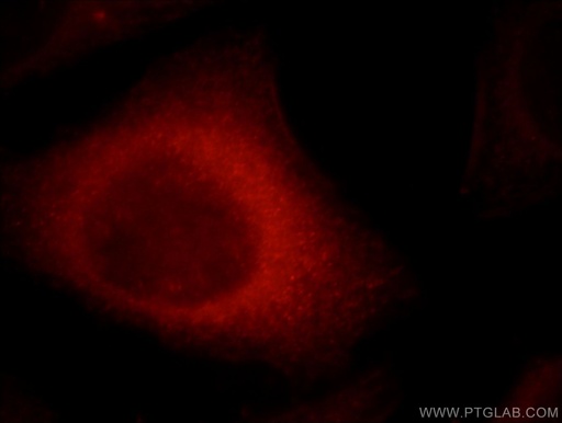 [21555-1-AP-20UL] CYP26B1 Polyclonal antibody