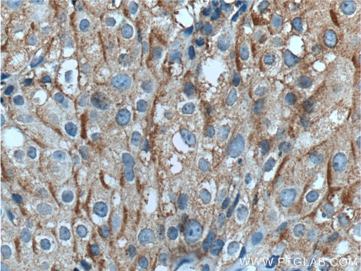 [21556-1-AP-150UL] TUSC5 Polyclonal antibody
