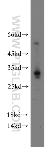 [21558-1-AP-20UL] CCDC70 Polyclonal antibody