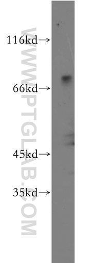 [21562-1-AP-20UL] ZNF699 Polyclonal antibody