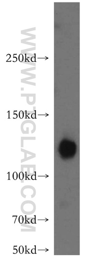 [21565-1-AP-150UL] ATP8A1 Polyclonal antibody