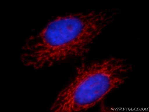 [21566-1-AP-150UL] NAGS Polyclonal antibody