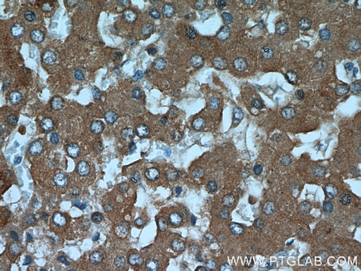 [21568-1-AP-20UL] SLC25A25 Polyclonal antibody